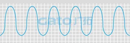 干貨|太全了,振動光纖7大場景的安裝方式圖文詳解!(圖21)